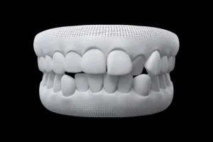 Aligner Trasparenti - Invisalign