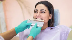 faccette dentali